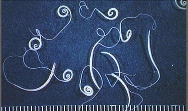 tricocéfalo del cuerpo humano