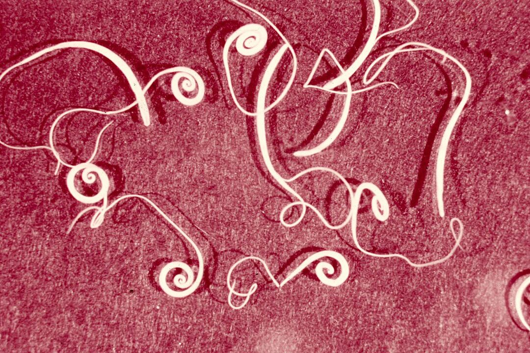 Trichinella espiralis humana