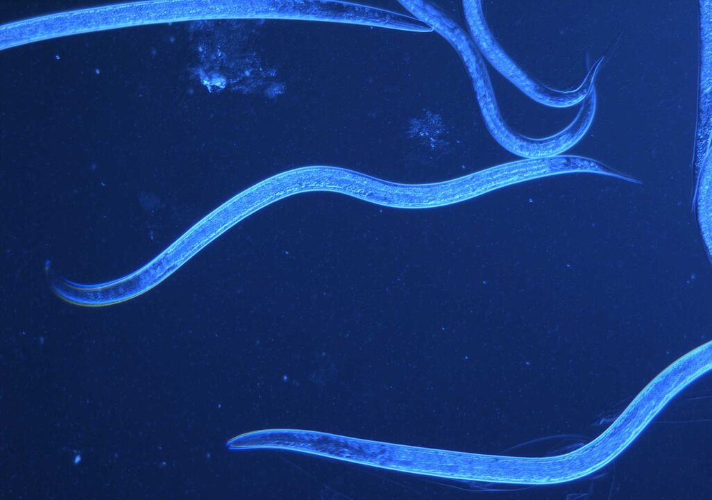 tricocéfalo humano